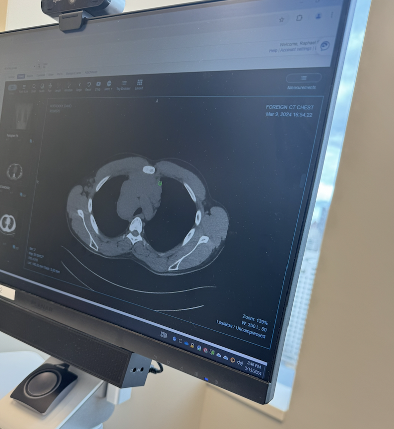CT scan view