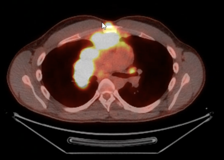 Detailed scan