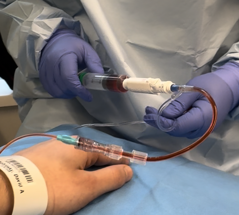 Normal infusion