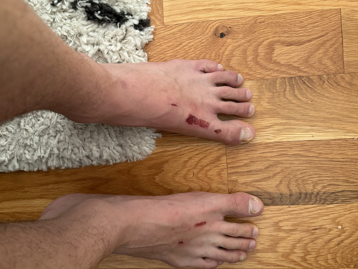 Itching comparison chart