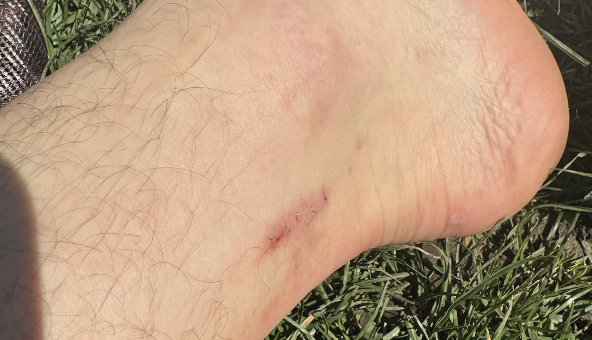 Current itching status